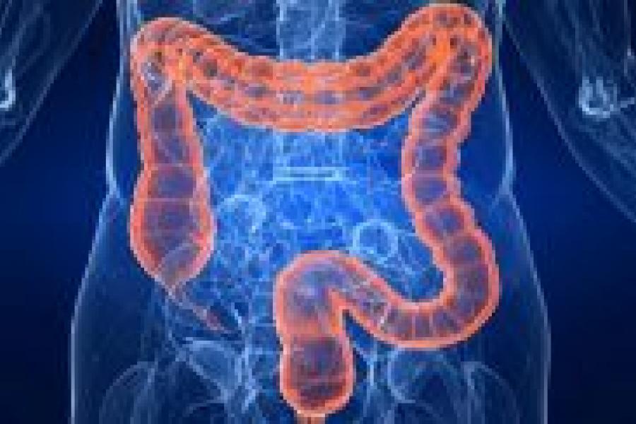 colon irritable
