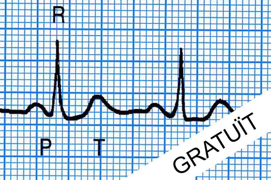 ECG