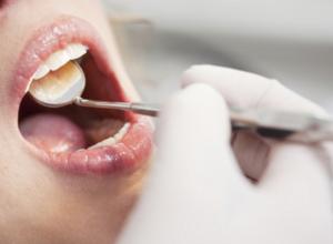 58 places d'odontologia a l'ICS